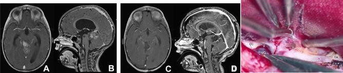 https://cdn.ncbi.nlm.nih.gov/pmc/blobs/406a/10432319/b34d70b35ddf/381_2022_5595_Fig5_HTML.jpg
