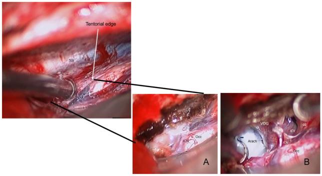 https://cdn.ncbi.nlm.nih.gov/pmc/blobs/406a/10432319/f70121b69543/381_2022_5595_Fig2_HTML.jpg