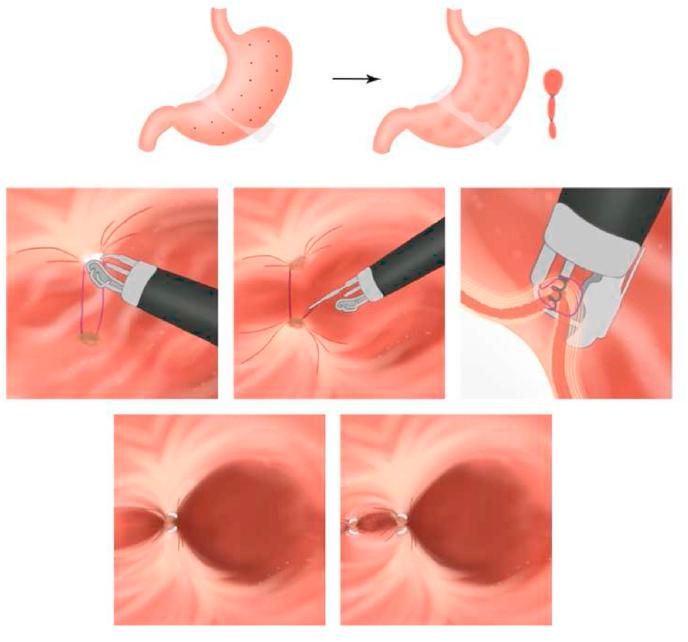 https://cdn.ncbi.nlm.nih.gov/pmc/blobs/406d/8636781/fd6b9be62c4b/gr15.jpg