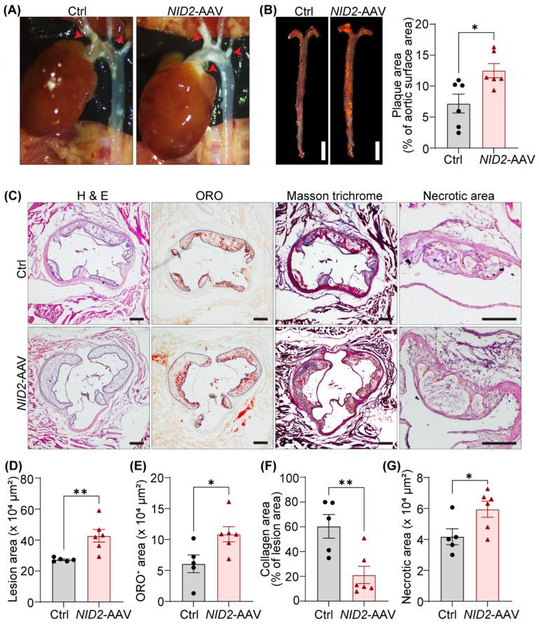 https://cdn.ncbi.nlm.nih.gov/pmc/blobs/406e/11641205/7bba889437ff/ijms-25-12782-g004.jpg