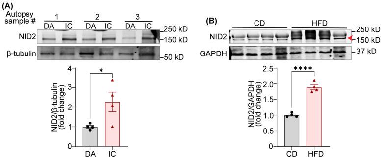 https://cdn.ncbi.nlm.nih.gov/pmc/blobs/406e/11641205/8793af0fa060/ijms-25-12782-g001.jpg