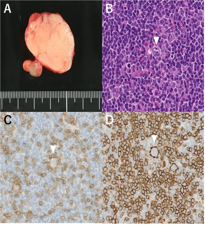 https://cdn.ncbi.nlm.nih.gov/pmc/blobs/4074/9803968/337eedda773f/rjac599f4.jpg