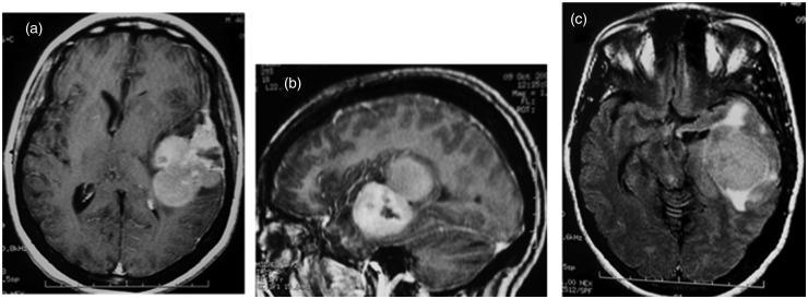 https://cdn.ncbi.nlm.nih.gov/pmc/blobs/4075/4184420/20dd2db1c98b/10.1177_2047981613494199-fig1.jpg