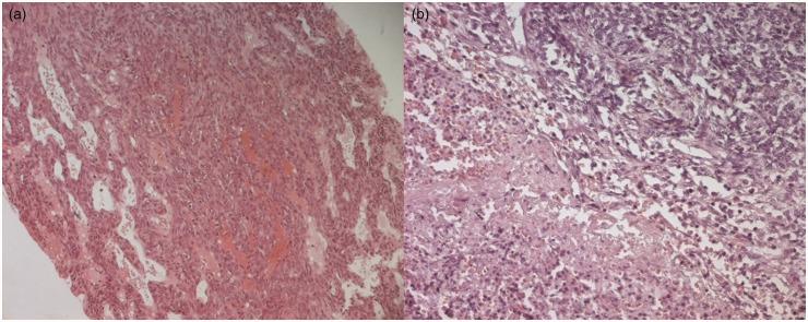 https://cdn.ncbi.nlm.nih.gov/pmc/blobs/4075/4184420/4f29a58f3f4d/10.1177_2047981613494199-fig5.jpg