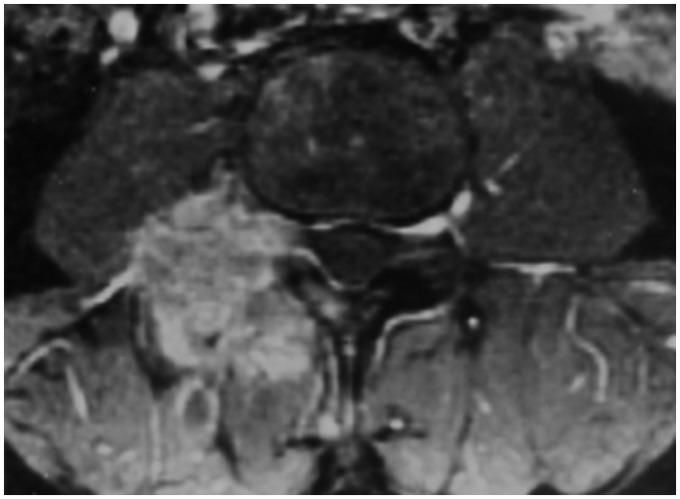 https://cdn.ncbi.nlm.nih.gov/pmc/blobs/4075/4184420/e92ef17f871f/10.1177_2047981613494199-fig3.jpg