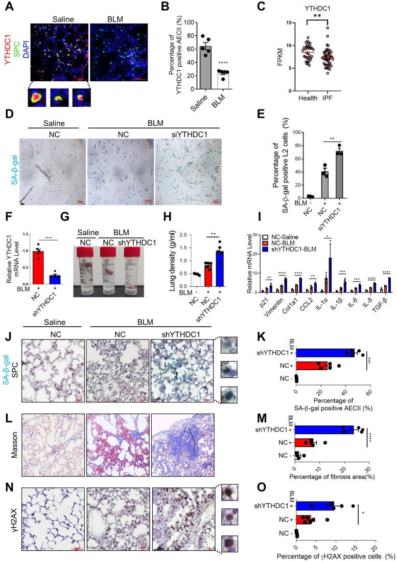 https://cdn.ncbi.nlm.nih.gov/pmc/blobs/407b/10883269/70478c924c9a/44318_2023_3_Fig1_HTML.jpg
