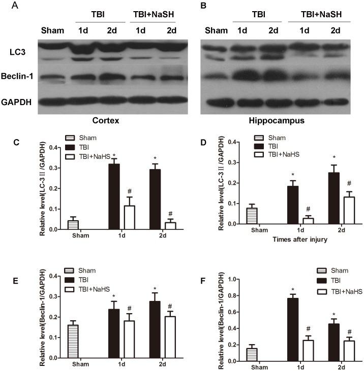 https://cdn.ncbi.nlm.nih.gov/pmc/blobs/407b/3900713/e8d10d92474d/pone.0087241.g006.jpg