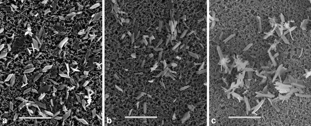 https://cdn.ncbi.nlm.nih.gov/pmc/blobs/4083/2812424/e9efd1ccd537/240_2009_239_Fig1_HTML.jpg