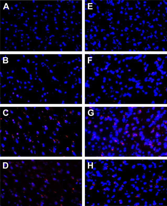 https://cdn.ncbi.nlm.nih.gov/pmc/blobs/4083/5357078/5d3a3d75556f/ijn-12-1959Fig1.jpg