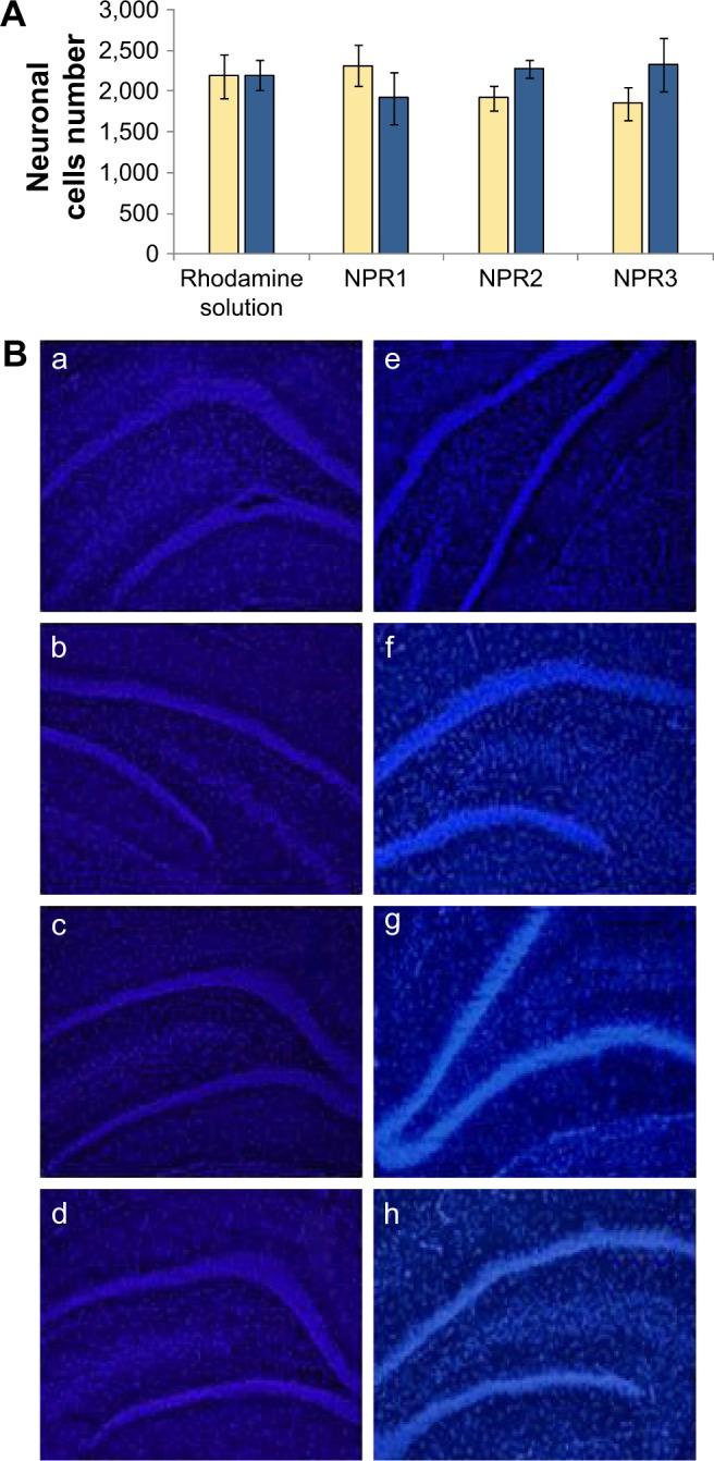 https://cdn.ncbi.nlm.nih.gov/pmc/blobs/4083/5357078/bb52af378969/ijn-12-1959Fig2.jpg