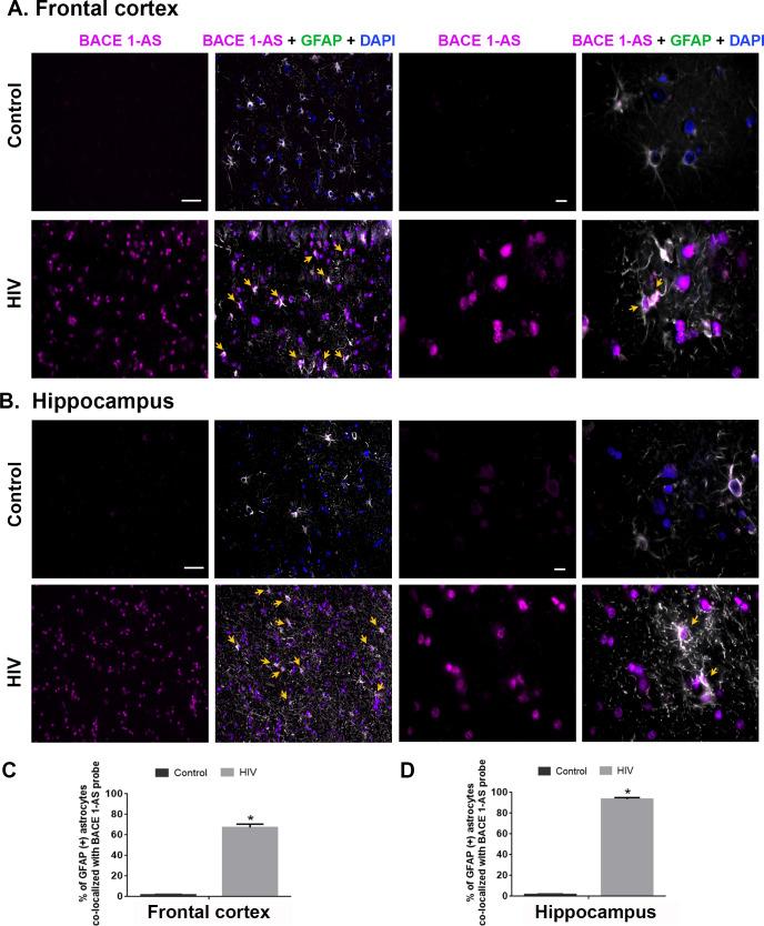 https://cdn.ncbi.nlm.nih.gov/pmc/blobs/4086/7274476/f90e51b433a1/pbio.3000660.g011.jpg