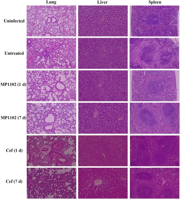 https://cdn.ncbi.nlm.nih.gov/pmc/blobs/408e/6399382/3c6d71782152/fcimb-09-00048-g0005.jpg