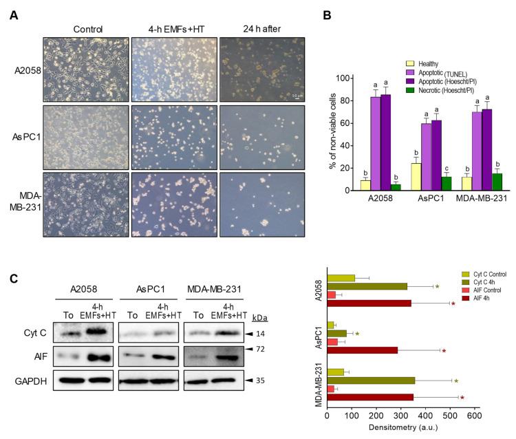 https://cdn.ncbi.nlm.nih.gov/pmc/blobs/4094/10340829/0b19220216a1/cancers-15-03413-g003.jpg