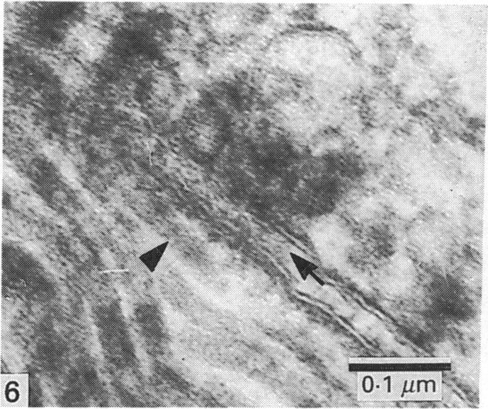 https://cdn.ncbi.nlm.nih.gov/pmc/blobs/4096/1256734/6ed18a1bc2f1/janat00044-0010-f.jpg