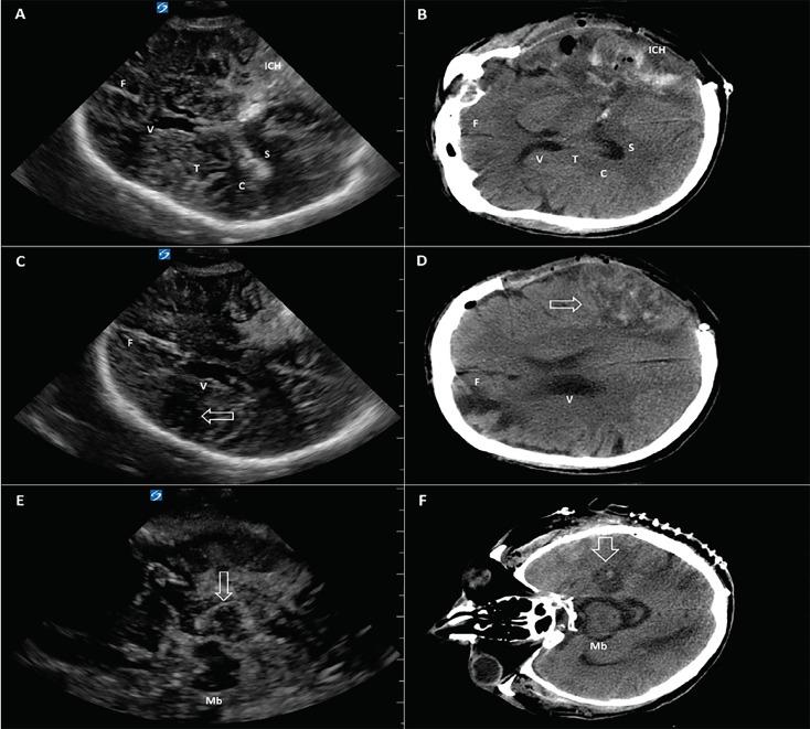https://cdn.ncbi.nlm.nih.gov/pmc/blobs/4098/6230339/2822beaaf8a3/cpcem-02-375-g001.jpg