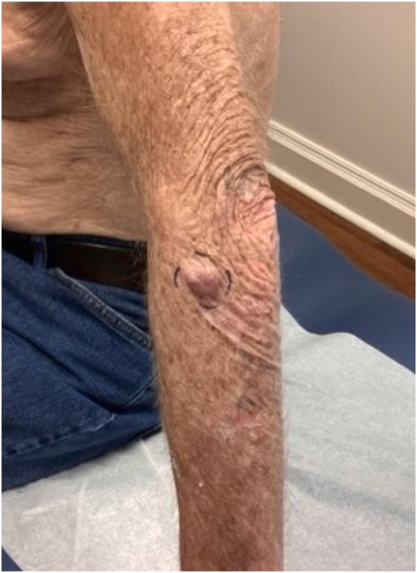 https://cdn.ncbi.nlm.nih.gov/pmc/blobs/40a3/11992405/258f6e920c29/gr1.jpg