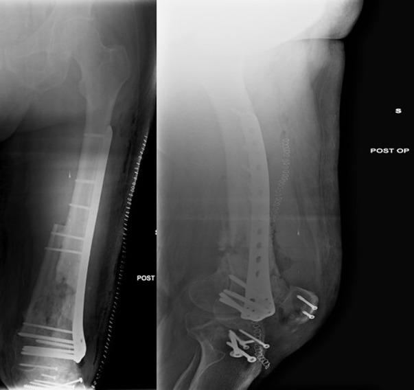 https://cdn.ncbi.nlm.nih.gov/pmc/blobs/40a6/7944819/37ab8fd69b06/ACTA-91-259-g007.jpg