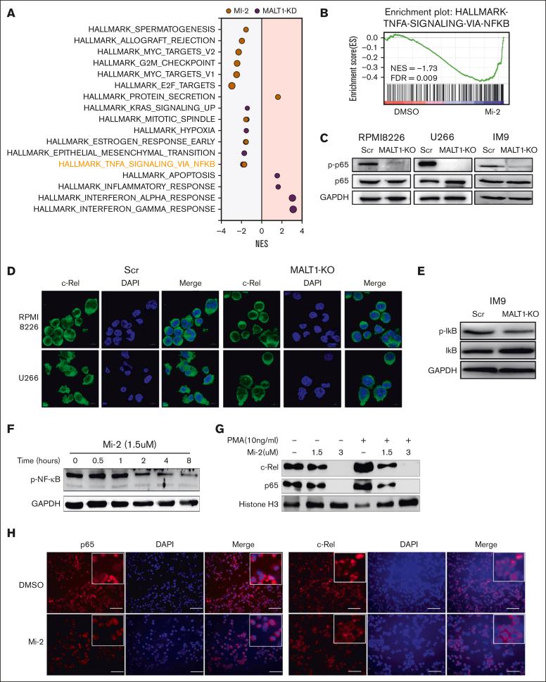 https://cdn.ncbi.nlm.nih.gov/pmc/blobs/40ad/11339052/dbb718988d28/BLOODA_ADV-2023-012394-gr3.jpg