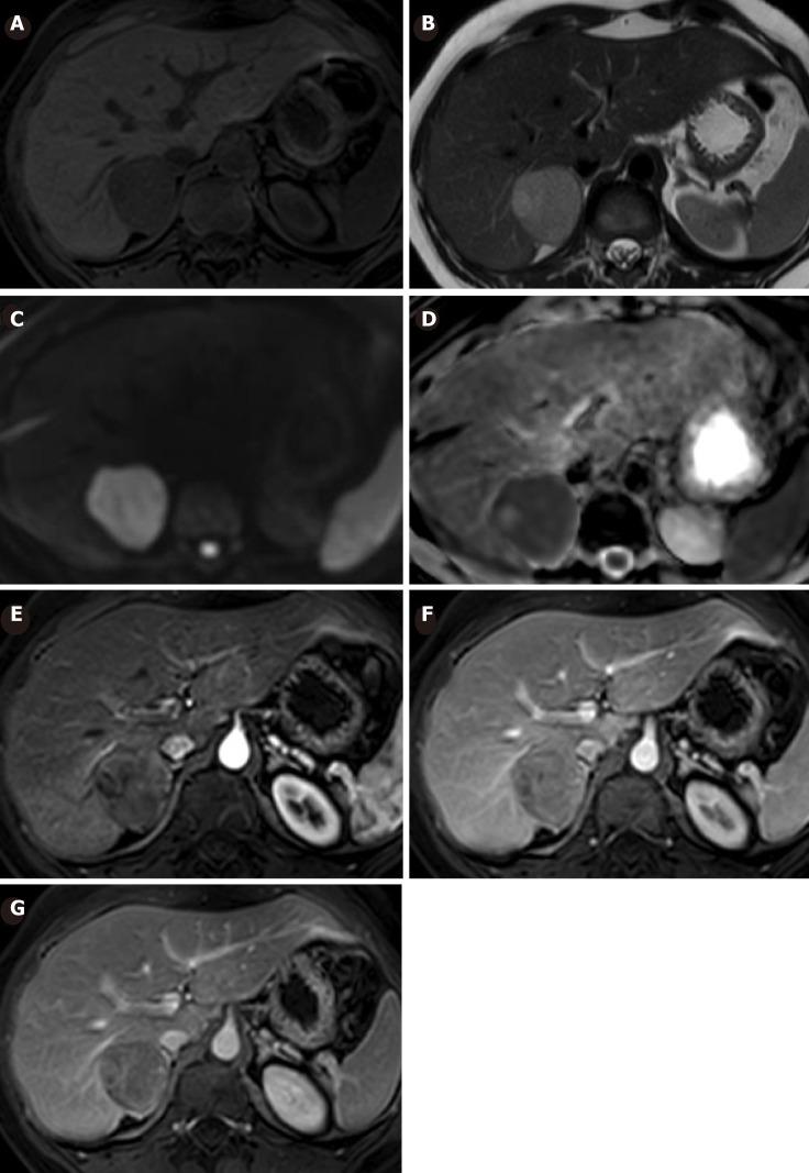https://cdn.ncbi.nlm.nih.gov/pmc/blobs/40ad/6513787/17d4687980ca/WJGS-11-229-g003.jpg