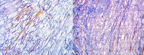 https://cdn.ncbi.nlm.nih.gov/pmc/blobs/40ad/6513787/ca17c738e898/WJGS-11-229-g005.jpg