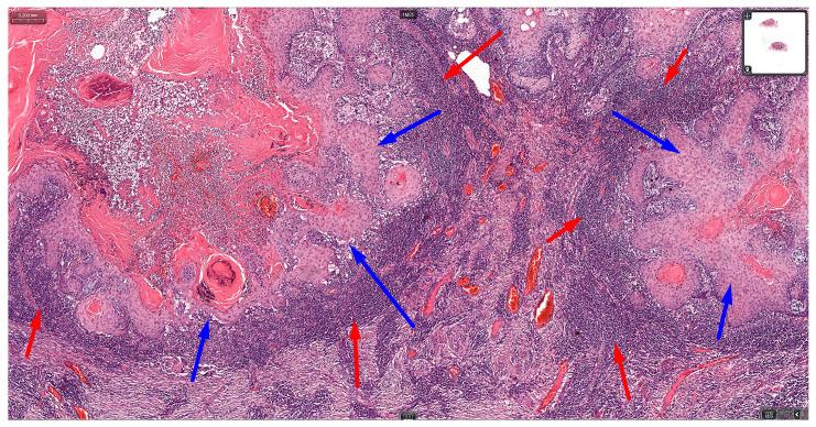 https://cdn.ncbi.nlm.nih.gov/pmc/blobs/40b3/11083853/3111db2c90ff/cancers-16-01727-g003.jpg