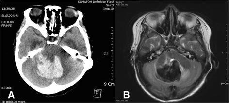 https://cdn.ncbi.nlm.nih.gov/pmc/blobs/40b3/5423006/25f8c8a30ff7/13256_2017_1274_Fig2_HTML.jpg