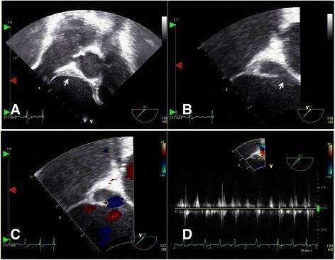 https://cdn.ncbi.nlm.nih.gov/pmc/blobs/40b3/5423006/fab3e98c3ca2/13256_2017_1274_Fig6_HTML.jpg