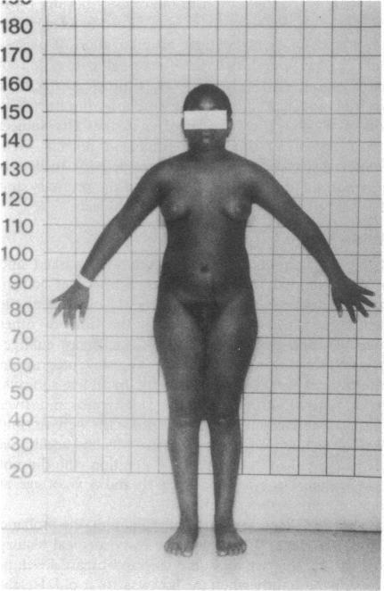 https://cdn.ncbi.nlm.nih.gov/pmc/blobs/40b5/425530/339a1c85c8f7/jcinvest00141-0022-a.jpg