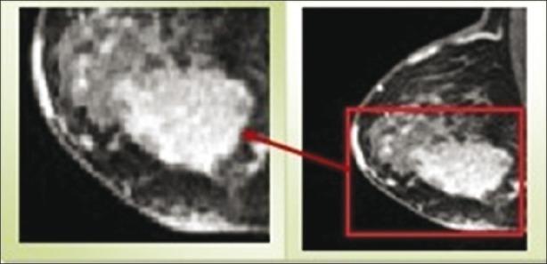 https://cdn.ncbi.nlm.nih.gov/pmc/blobs/40bf/3342621/ef3ba8fe30b1/JMSS-1-138-g001.jpg