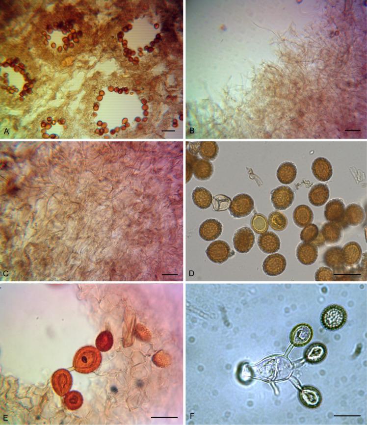 https://cdn.ncbi.nlm.nih.gov/pmc/blobs/40c8/8687231/e5c3963343c1/fuse-2021-8-8-g003.jpg