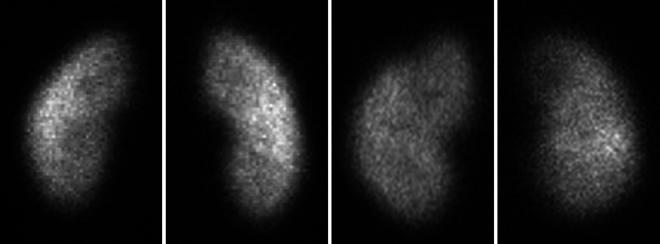 https://cdn.ncbi.nlm.nih.gov/pmc/blobs/40c9/11137416/5bd154f97c00/gr002.jpg