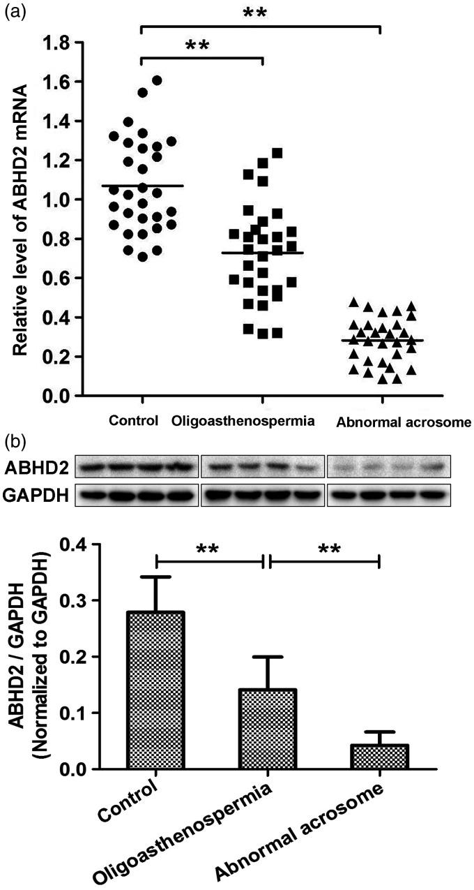 https://cdn.ncbi.nlm.nih.gov/pmc/blobs/40cb/7995462/374cb0c34ded/10.1177_0300060521999527-fig1.jpg