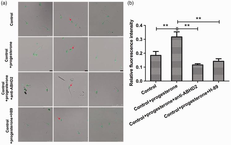 https://cdn.ncbi.nlm.nih.gov/pmc/blobs/40cb/7995462/7cd46d533be8/10.1177_0300060521999527-fig5.jpg