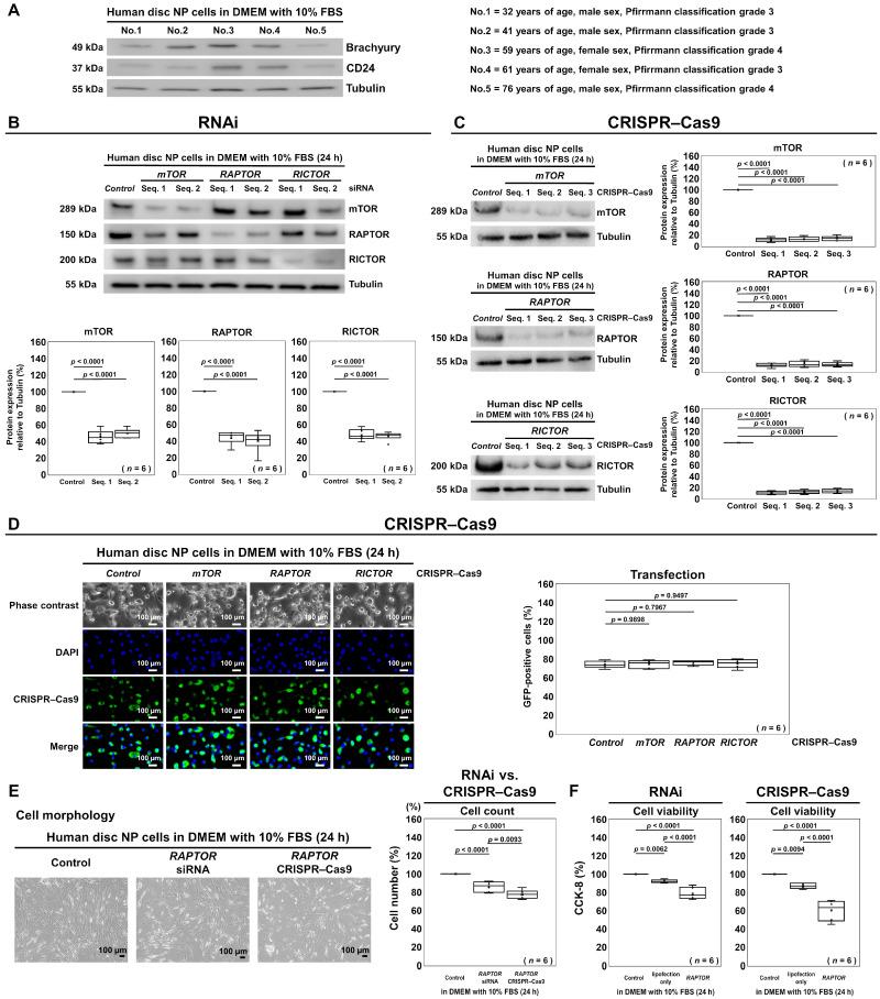 https://cdn.ncbi.nlm.nih.gov/pmc/blobs/40d1/11640589/e6e842ee35f6/cells-13-02030-g003.jpg