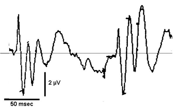https://cdn.ncbi.nlm.nih.gov/pmc/blobs/40d5/1636633/ab6c12bcf92e/1749-7221-1-4-2.jpg
