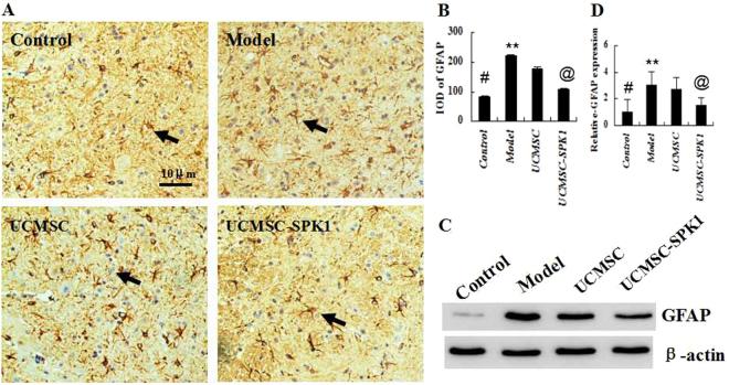 https://cdn.ncbi.nlm.nih.gov/pmc/blobs/40d9/5788935/5962ef2a919b/41598_2018_19703_Fig4_HTML.jpg