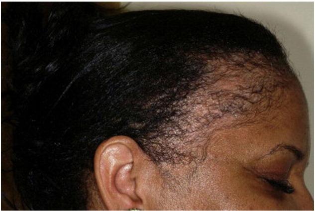 https://cdn.ncbi.nlm.nih.gov/pmc/blobs/40e4/5419061/63dc92b8aecb/gr9.jpg