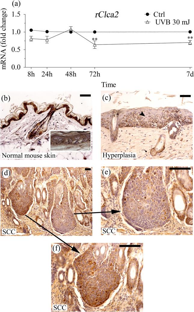 https://cdn.ncbi.nlm.nih.gov/pmc/blobs/40f3/8134295/180c79a991ed/418_2021_1962_Fig4_HTML.jpg