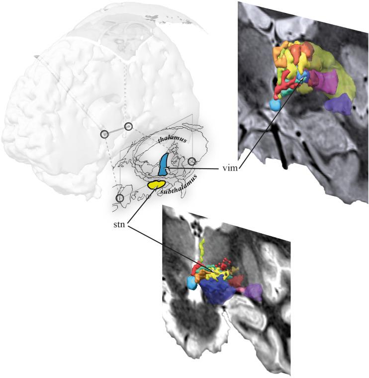https://cdn.ncbi.nlm.nih.gov/pmc/blobs/40fd/8226181/377699c1e8c4/fbioe-09-657875-g003.jpg