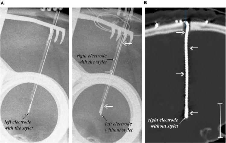 https://cdn.ncbi.nlm.nih.gov/pmc/blobs/40fd/8226181/966bca438feb/fbioe-09-657875-g002.jpg