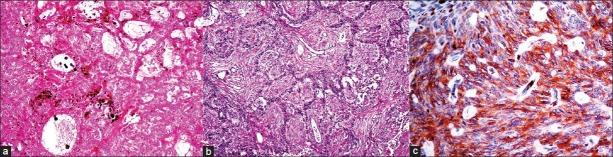 https://cdn.ncbi.nlm.nih.gov/pmc/blobs/40fe/3543602/e832a5345b20/JCytol-29-273-g002.jpg