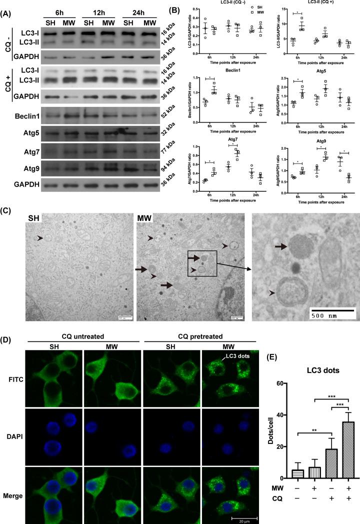 https://cdn.ncbi.nlm.nih.gov/pmc/blobs/4101/9069443/771973a1ba64/bsr-42-bsr20212584-g2.jpg