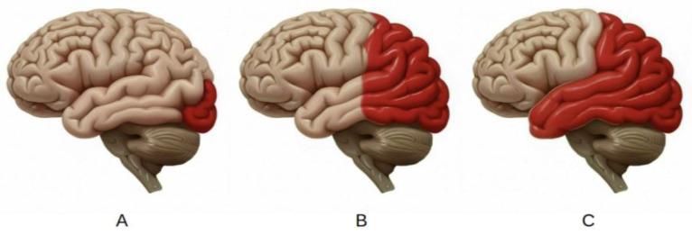 https://cdn.ncbi.nlm.nih.gov/pmc/blobs/4104/11858725/1b69c5ff6d53/neurolint-17-00015-g001.jpg