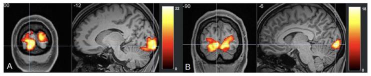 https://cdn.ncbi.nlm.nih.gov/pmc/blobs/4104/11858725/ad04e7ceea15/neurolint-17-00015-g003.jpg