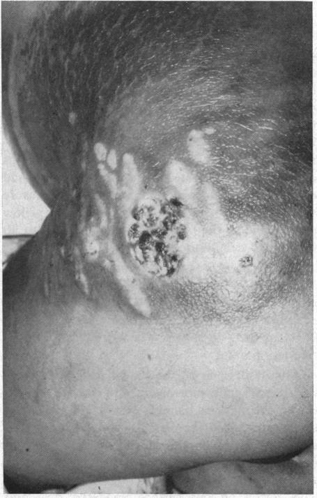 https://cdn.ncbi.nlm.nih.gov/pmc/blobs/4104/1502622/7907b65a5ff1/califmed00043-0061-a.jpg