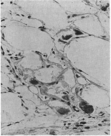 https://cdn.ncbi.nlm.nih.gov/pmc/blobs/4104/1502622/8a2f0ae07dba/califmed00043-0063-a.jpg