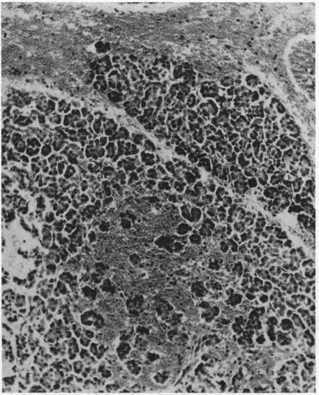 https://cdn.ncbi.nlm.nih.gov/pmc/blobs/4104/1502622/ee75477cd0f2/califmed00043-0062-a.jpg