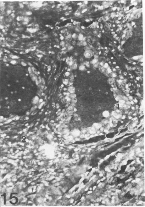 https://cdn.ncbi.nlm.nih.gov/pmc/blobs/4104/1877628/016a47dd4e5c/amjpathol00112-0211-b.jpg