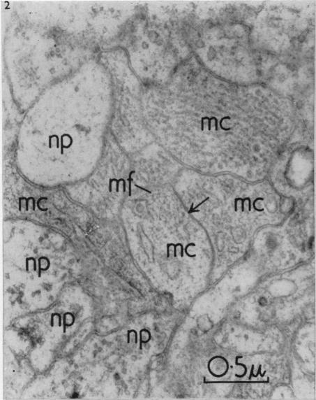https://cdn.ncbi.nlm.nih.gov/pmc/blobs/410a/1244141/2f4b1ac5bf0d/janat00431-0065-b.jpg