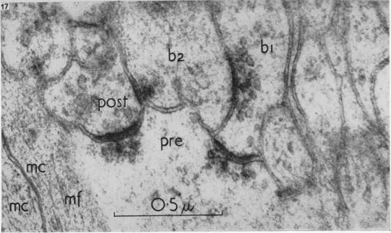 https://cdn.ncbi.nlm.nih.gov/pmc/blobs/410a/1244141/39da987787bf/janat00431-0067-d.jpg